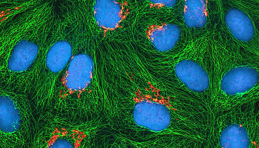 Image of cells made with fluorescent microscopy (Image credit: nih.gov)